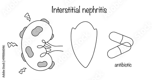 Interstitial nephritis