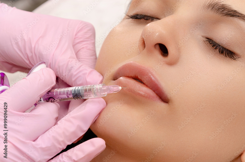 Young woman gets filler injection in her lips at a beauty salon. Lip augmentation procedure. Young woman gets filler injection in her lips at a beauty salon. Lip augmentation procedure.