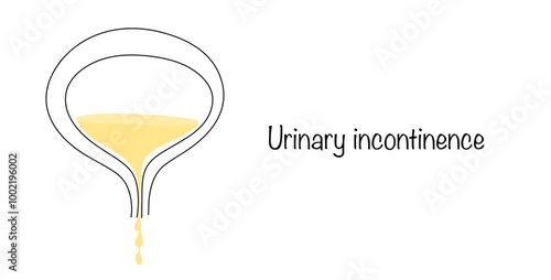 Urinary incontinence