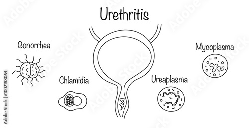 Urethritis