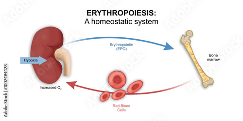 Erythropoiesis: A homeostatic system, Anemia in chronic kidney disease