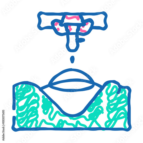 laser correction ophthalmology doodle icon sketch vector. laser correction ophthalmology sign. isolated symbol illustration