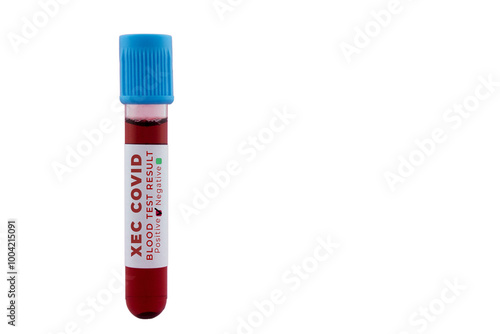 A test tube filled with blood labeled xec covid blood sample isolated on a white background.

 photo