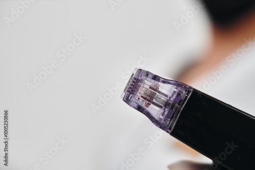 Close-up view of a microneedling device being held in a clinic setting