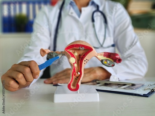 Gynecologist and scalpel with female reproductive system photo