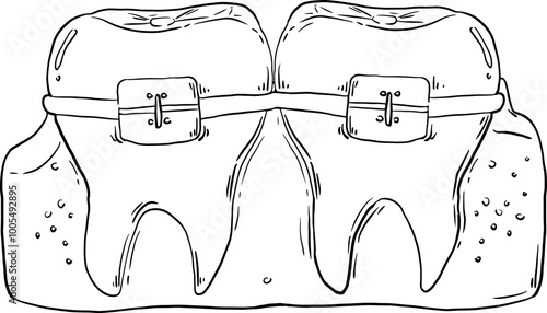 sketch braces dental