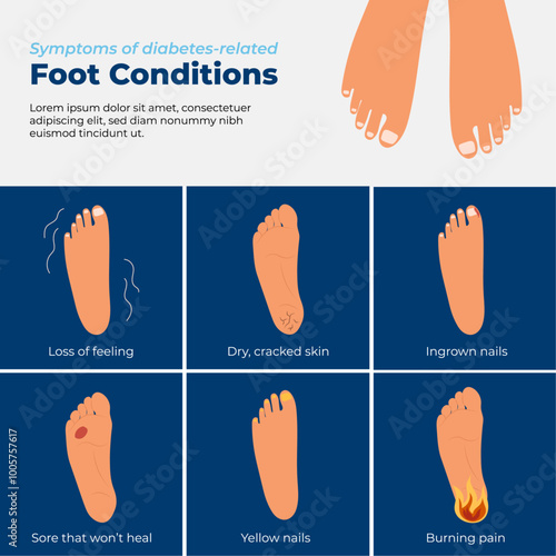 world diabetes day awareness infographic foot condition symptoms flat illustration