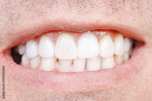 close-up. The man smiles and shows his teeth. oral hygiene. Dental veneers.