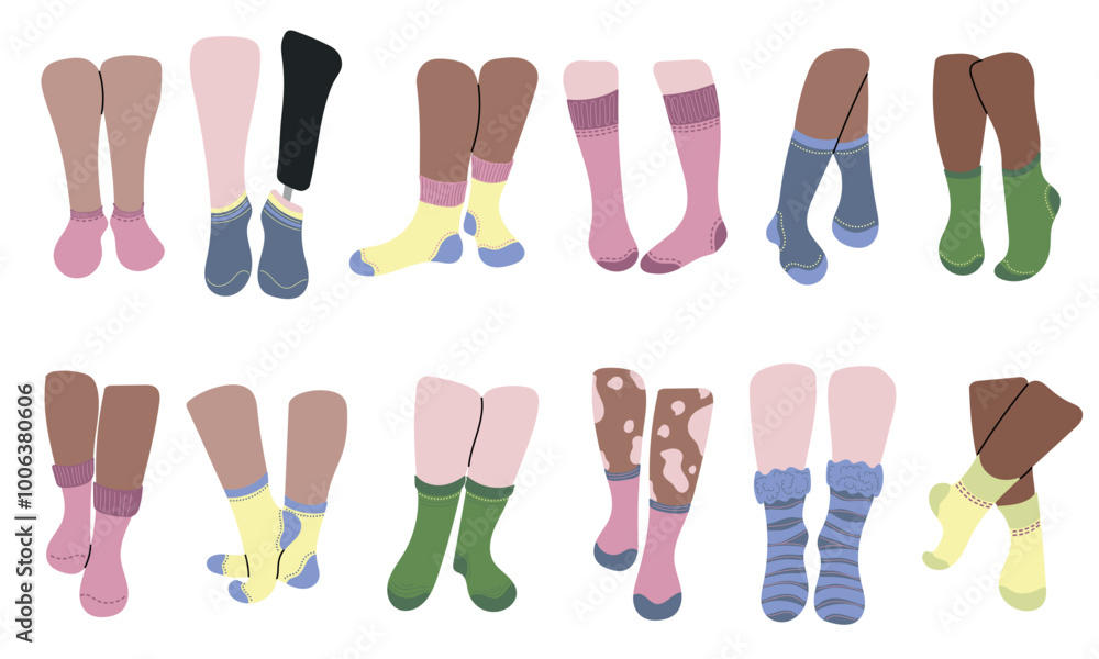 Beautiful socks design on legs. Concept of diversity white, black color skin, vitiligo, inclusive person with prosthetic leg. Blue, pink, green, yellow socks. Low cut, ankle, knee high, over the calf Beautiful socks design on legs. Concept of diversity white, black color skin, vitiligo, inclusive person with prosthetic leg. Blue, pink, green, yellow socks. Low cut, ankle, knee high, over the calf