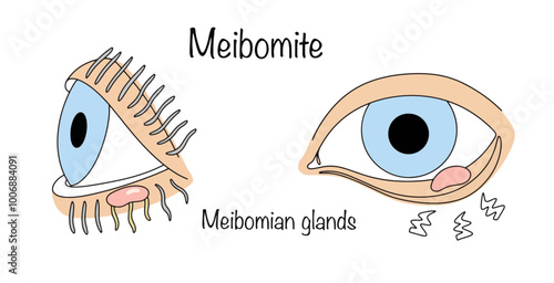 Meibomite