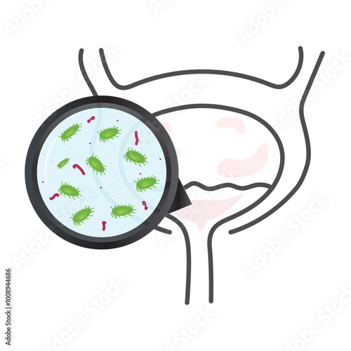 Urinary tract infection(UTI) vector. Illustration of infect the urinary tract.