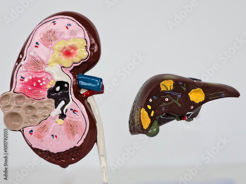 Kidney and liver diseases. Importance of the liver for kidney health photo