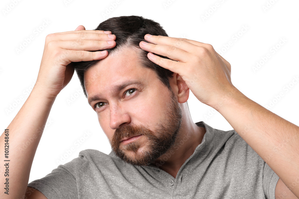Man with hair loss problem on white background Man with hair loss problem on white background