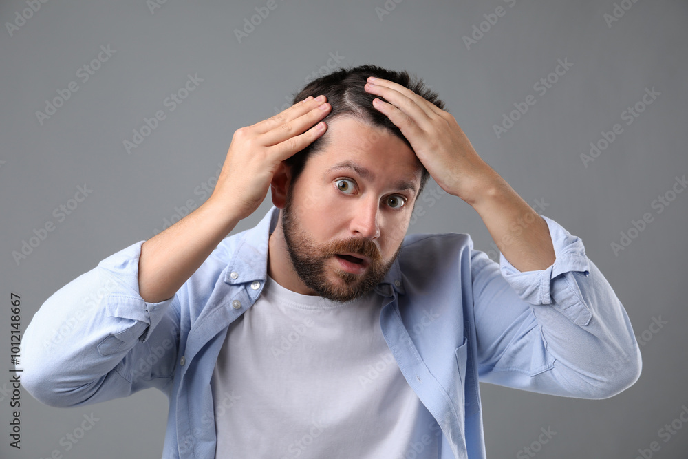 Man with hair loss problem on gray background Man with hair loss problem on gray background