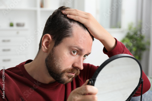 Принти на полотні Man with hair loss problem looking at mirror indoors