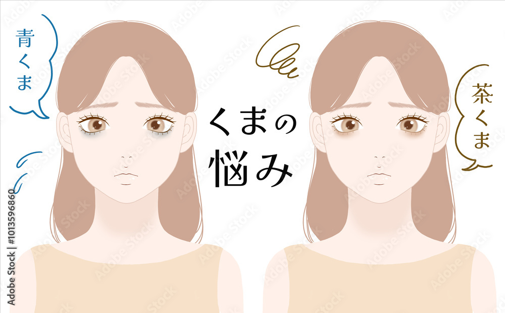 目のクマに悩む女性のイラスト 目のクマに悩む女性のイラスト