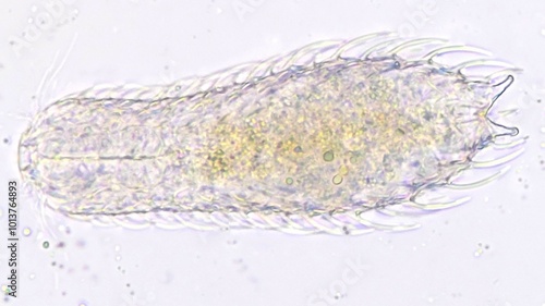 Принти на полотні Acoelomate gastrotrichs, Chaetonotus sp