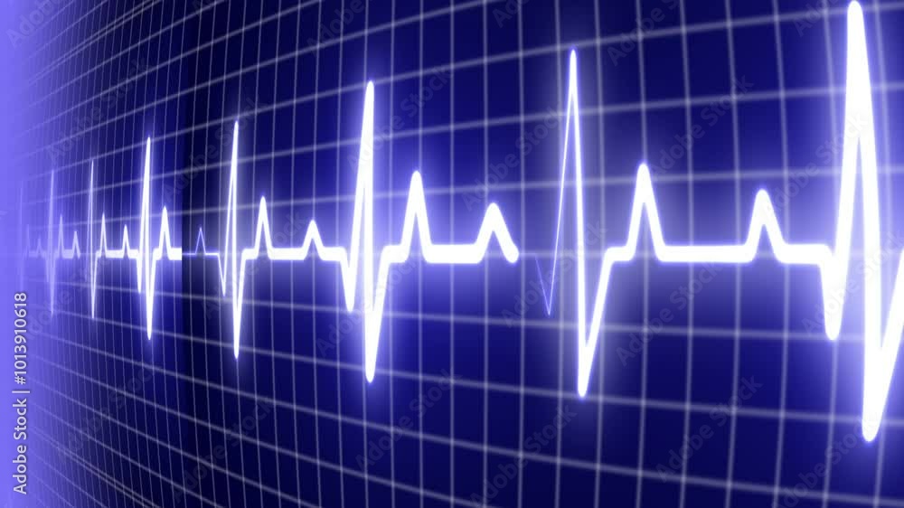 EKG ECG flatline. Heart beat line on monitor of electrocardiogram machine in extreme close-up, seamless loop EKG ECG flatline. Heart beat line on monitor of electrocardiogram machine in extreme close-up, seamless loop