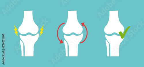 Knee joint concept. The disease of the disease, the treatment of the disease, the prolongation of the disease. Chondroprotectors, physiotherapy, exercise therapy. Vector design