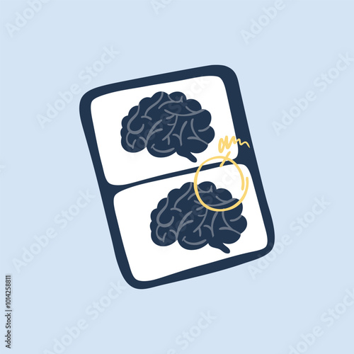 brain scanner paper in flat vector design.