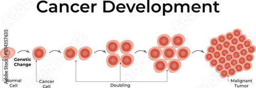 Cancer Development Normal Cell Cancer Cell Vector Illustration