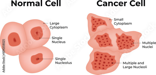 Normal Cell Cancer Cell Large Cytoplasm Single Nucleus Single Nucleolus Vector Illustration