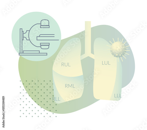 Covid-19 Testing - CT Scan - Human Lungs HRCT - Illustration