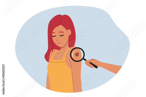 Melanoma or malignant tumor found on shoulder of woman standing near magnifying glass. Girl with cancer suffers from melanoma caused by bad climate or hereditary disease inherited from parents