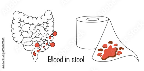 Blood in stool