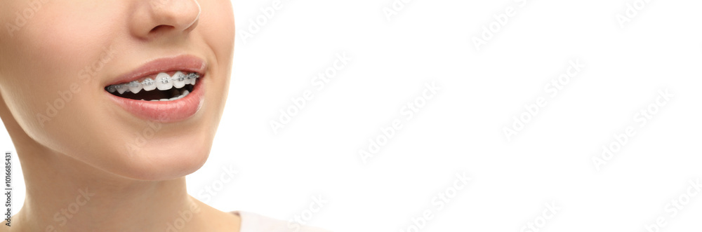 Obraz premium Woman with braces on white background, closeup. Banner design with space for text