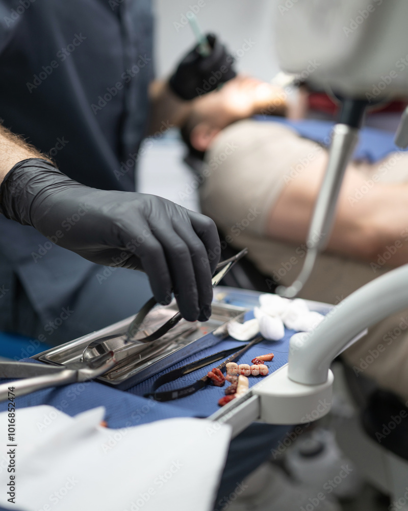 Dentist extracts teeth of patient. Focus on extracted teeth and instruments on tray. Removed orthodontic dental bridge along with diseased teeth. Dental Surgery. Prosthetic teeth, implant placement. Dentist extracts teeth of patient. Focus on extracted teeth and instruments on tray. Removed orthodontic dental bridge along with diseased teeth. Dental Surgery. Prosthetic teeth, implant placement.