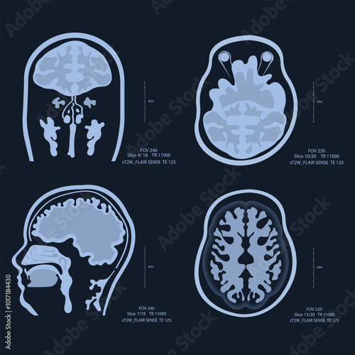 MRI - Magnetic Resonance Imaging - Illustration. X-ray images of the brain