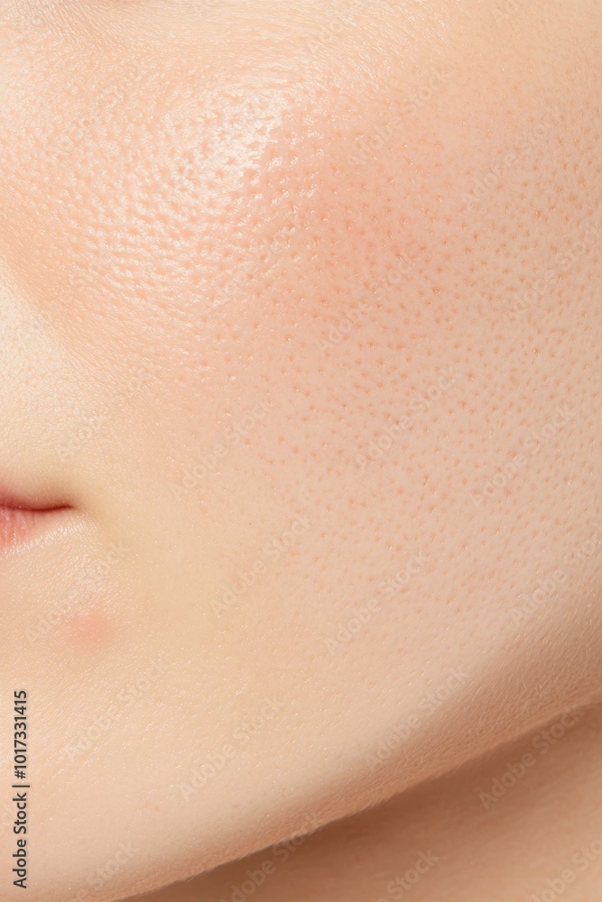 A closeup of problematic skin with visible acne and redness before treatment, set against a neutral background, ideal for skincare tutorials and product use. A closeup of problematic skin with visible acne and redness before treatment, set against a neutral background, ideal for skincare tutorials and product use.