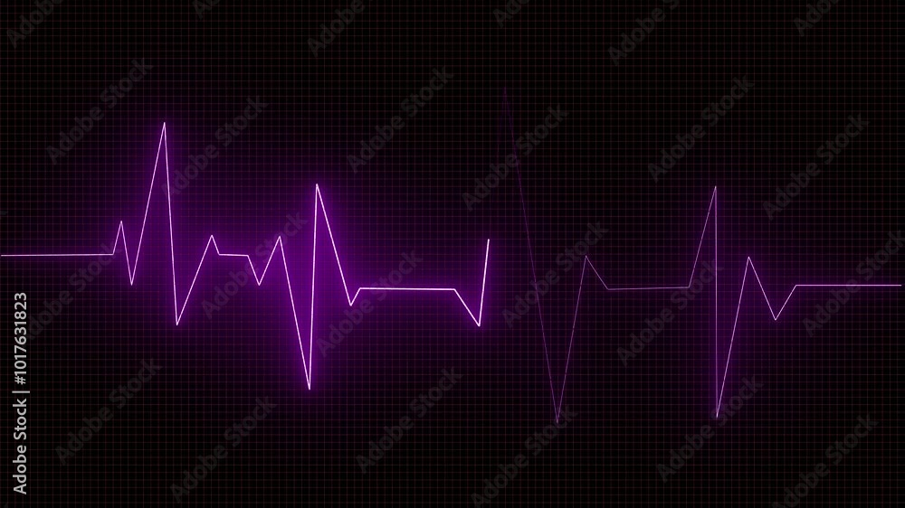 Heartbeat monitor animation A smooth animation in high quality on a heart rate monitor in a hospital environment Heartbeat monitor animation A smooth animation in high quality on a heart rate monitor in a hospital environment
