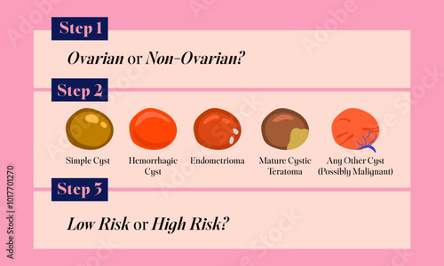 female reproductive system ovarian cyst analyze illustration