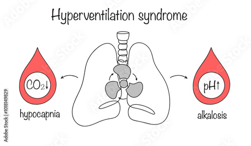 Hyperventilation syndrome
