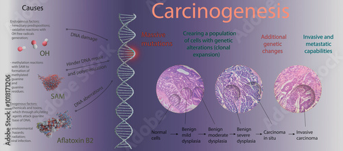 Foto infographic of cancerogenesis, 3d illustration