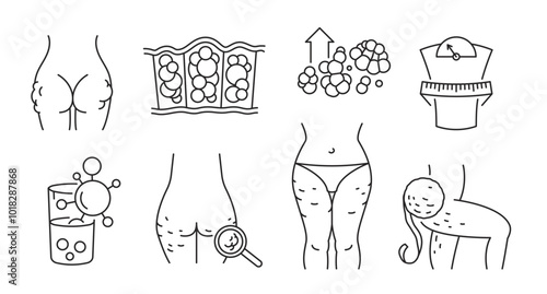 Cellulite outline icon. Gynoid lipodystrophy linear pictogram.