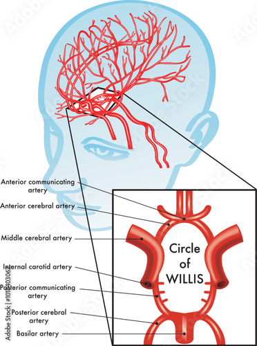 Medical illustration showing the location of the Circle of Willis in the brain.