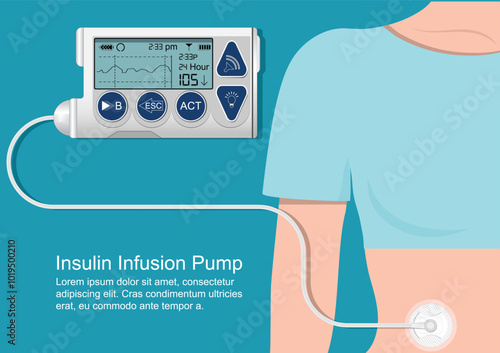 Insulin infusion pump is a device.