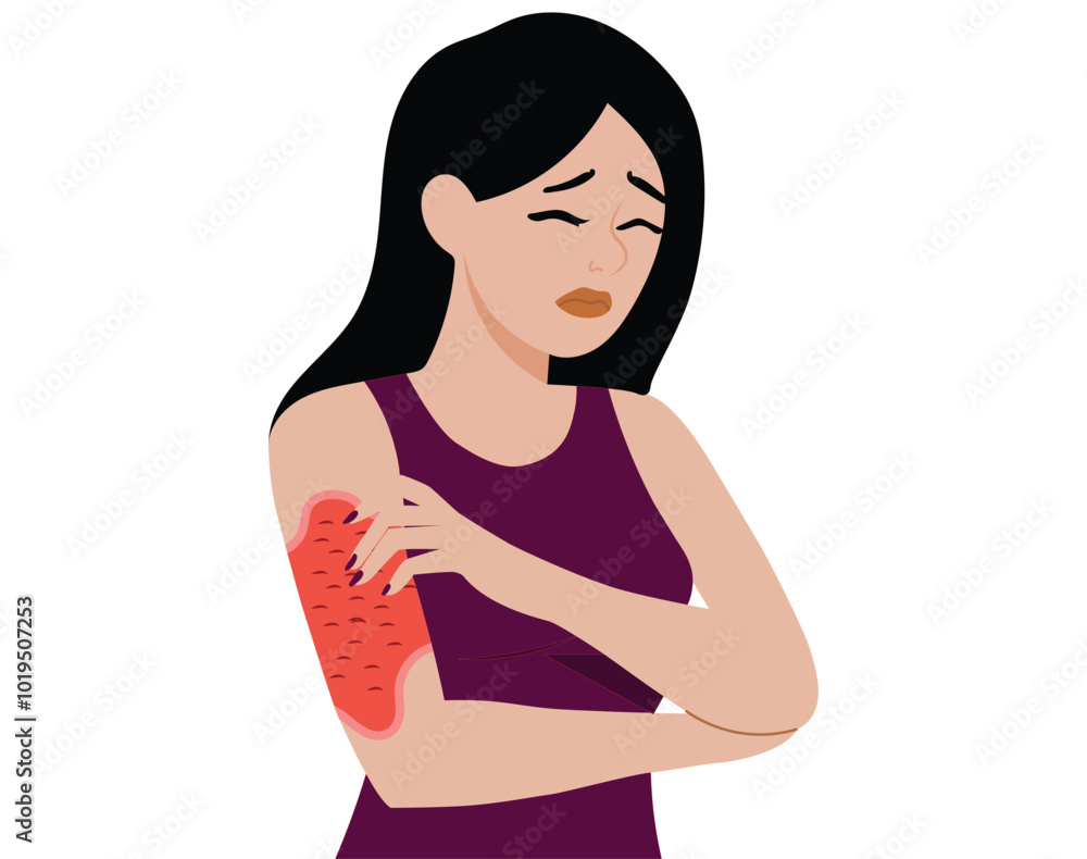 Young woman Red rash skin flat vector illustration. Young woman Red rash skin flat vector illustration.