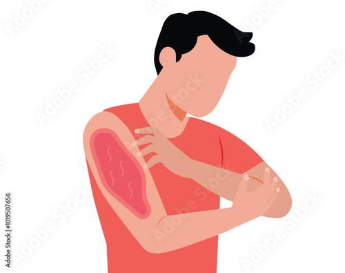 Young man allergy skin itchy symptom in flat vector design. Red rash skin illustration.