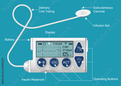 Structure of Generic Insulin infusion Pump.