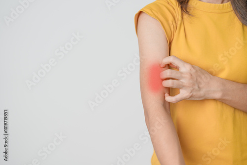 Wallpaper Mural woman itching and scratching itchy arm. Sensitive Skin Allergic reaction to insect bite, food, drug dermatitis. Dermatology, Leprosy day, Systemic lupus erythematosus, Allergy symptoms and rash Eczema Torontodigital.ca
