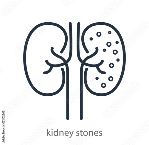 Kidney stones icon. Disease of the urogenital system. Human urinary system. Anatomy. Internal organ. Vector illustration isolated on white background