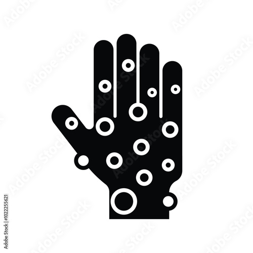 chicken pox on the hands black