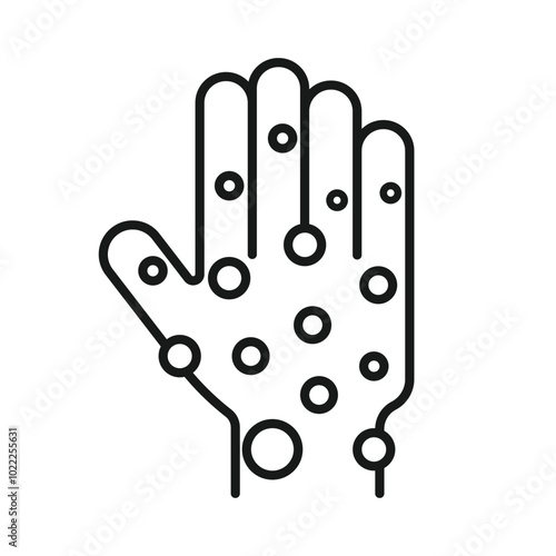 chicken pox on the hands outline
