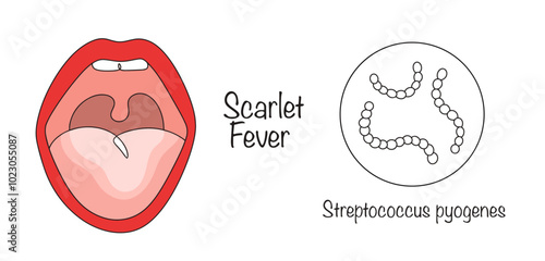 Scarlet Fever