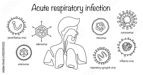 Acute respiratory infection