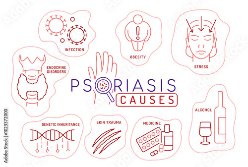 Psoriasis causes linear infographic. Medical dermatitis factors.